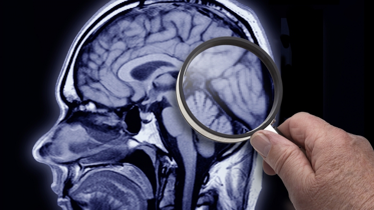 Cum o să poți uita ce vrei: specialiștii știu cum să șteargă amintiri din creier!