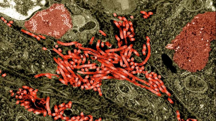 Ebola face noi victime. Bilanț alarmant al deceselor din cauza cumplitei maladii 