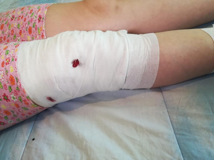  Caz șocant în Sibiu: Fetiță de 10 ani sfâșiată de un câine maidanez. FOTO