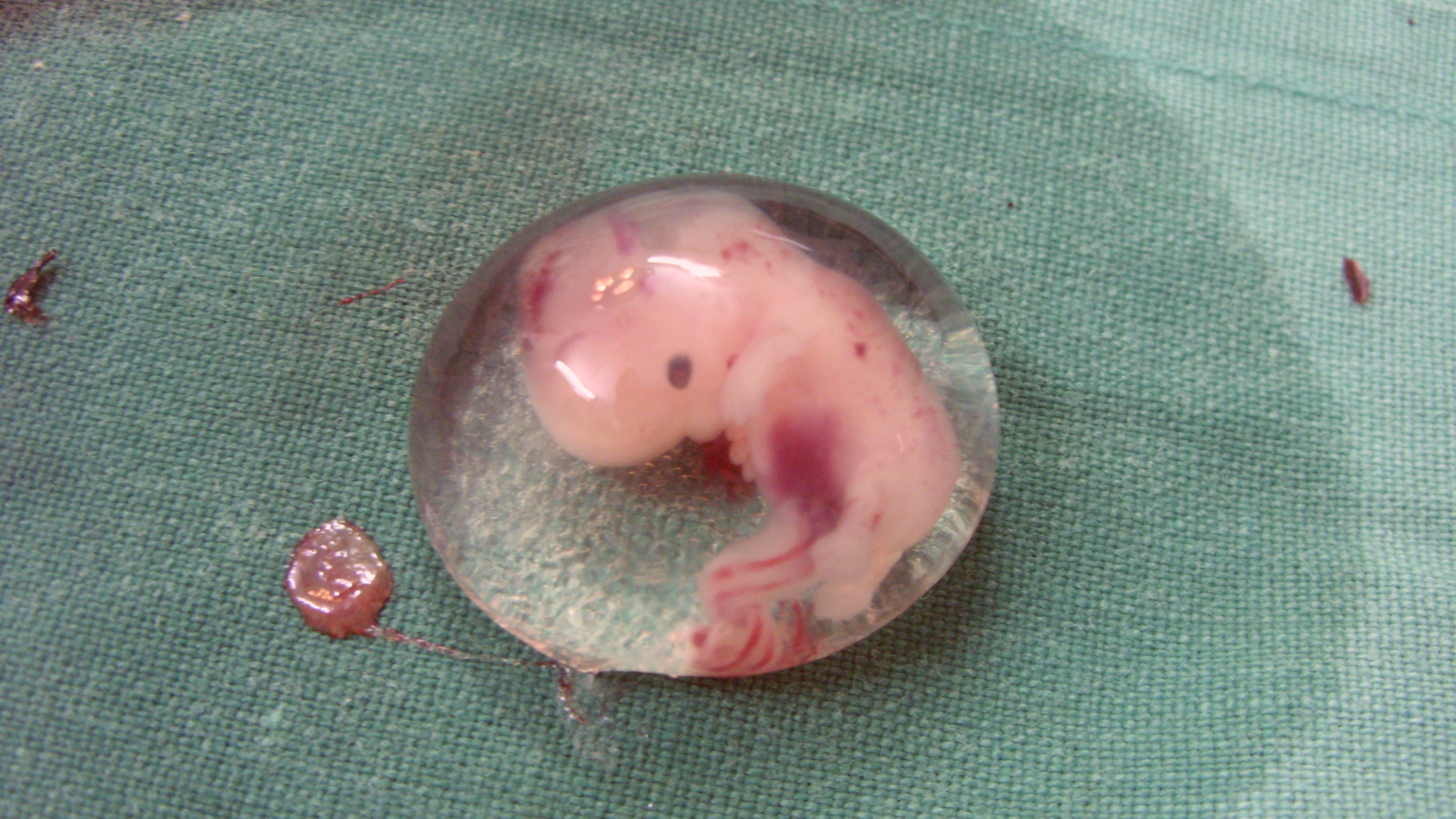 A fost creat primul embrion uman de laborator, fără a se folosi ovule si spermatozoizi