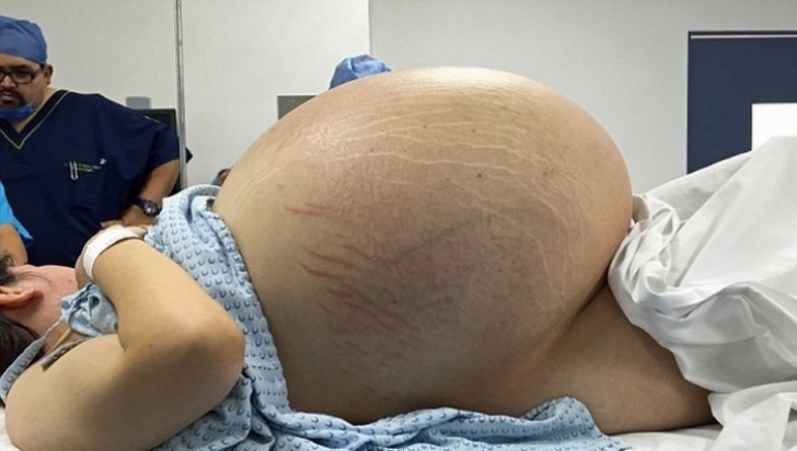 A ajuns la spital, medicii au zis că e însărcinată. Fata a negat. Ce i-au găsit în burtă..e șocant