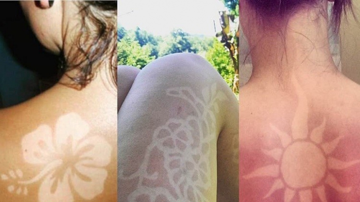 Cea mai periculoasă modă a verii: arsuri solare pe piele sub formă de desene artistice