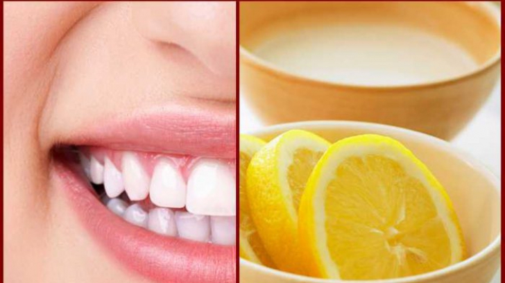 Cât de eficiente sunt tratamentele alternative pentru albirea dinților