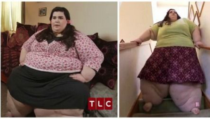 Doctorul a refuzat să o opereze pe fată. După un an a revăzut-o și nu i-a venit să creadă