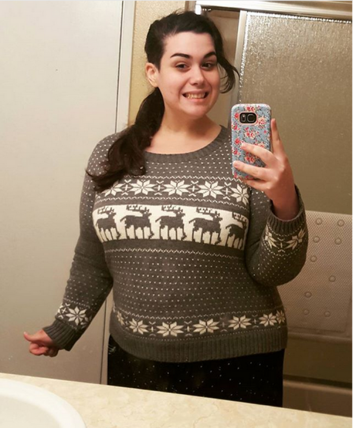 Doctorul a refuzat să o opereze pe fată. După un an a revăzut-o și nu i-a venit să creadă