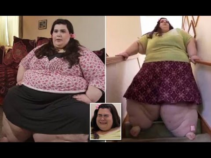 Doctorul a refuzat să o opereze pe fată. După un an a revăzut-o și nu i-a venit să creadă