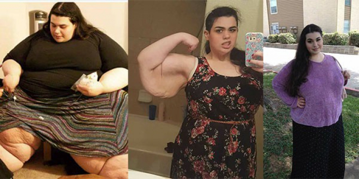 Doctorul a refuzat să o opereze pe fată. După un an a revăzut-o și nu i-a venit să creadă