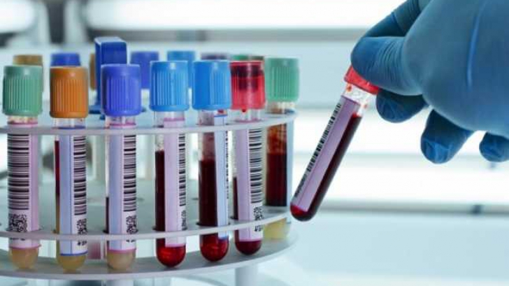 Există un test de sânge pe care îl poți face ca să afli dacă mori într-un deceniu