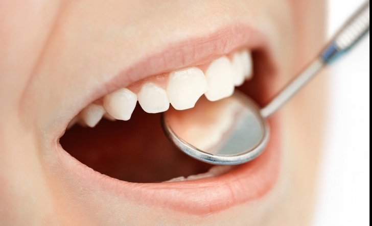 Sigilarea dentară la copii