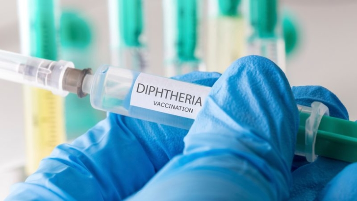 Difterie/Arhivă foto