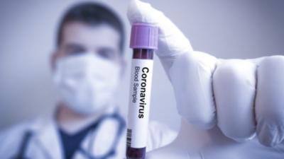 Bilanțul deceselor în România, actualizat: 29 persoane infectate cu coronavirus au murit. Cine este ultima victimă