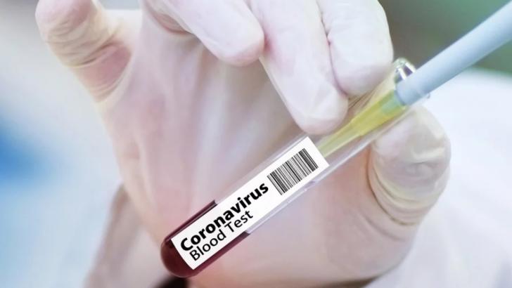 Bilanțul deceselor în România, actualizat: 85 persoane infectate cu coronavirus au murit