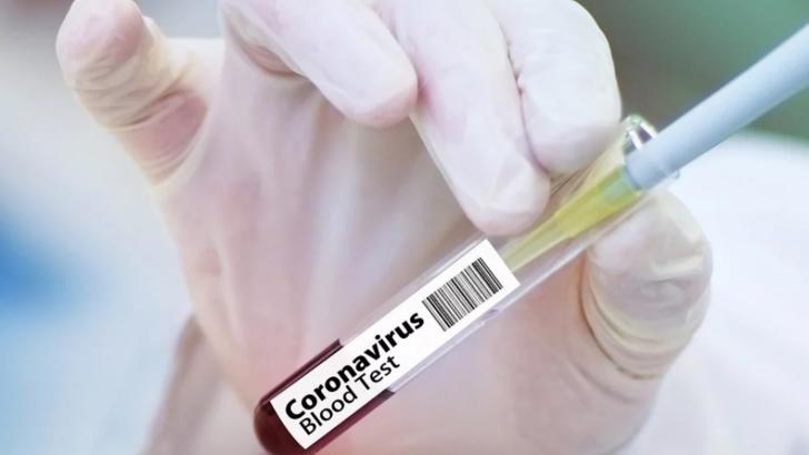 Bilanțul deceselor în România, actualizat: încă 4 persoane infectate cu coronavirus au murit