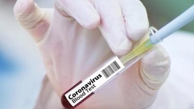 Șapte cazuri de COVID-19 în rândul personalului de la SJ Brăila