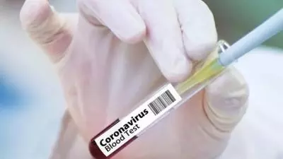 Test COVID-19
