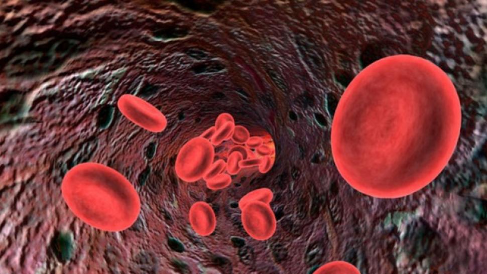 Eliminare Cheaguri De Sange In Urina La ce afecţiuni eşti predispus, în funcție de grupa ta sanguină