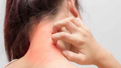 Alergie in functie de zodie