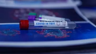 Testele COVID-19 de salivă sunt analizate în România, nu sunt incluse în procedura din UE