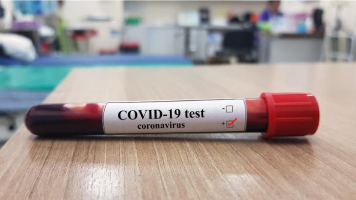 Nou caz de Covid-19 la IPJ Prahova