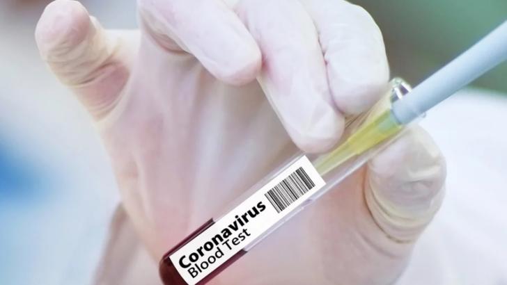 testare coronavirus