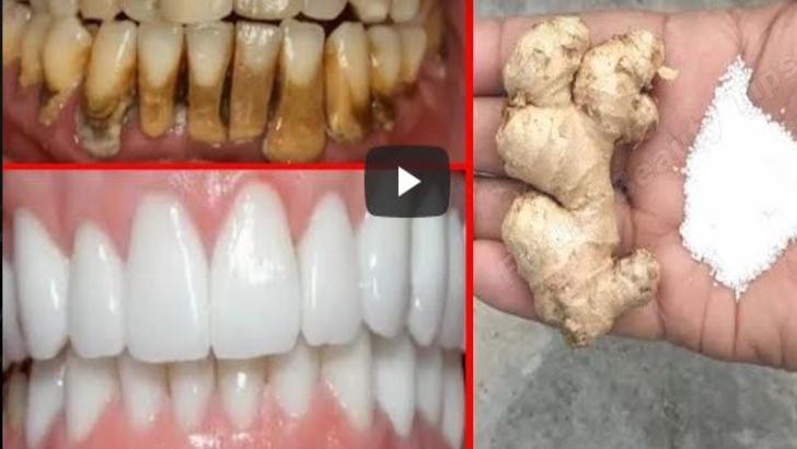 VIDEO – Amestecul care iți albește dinții într-un timp foarte scurt – Cum se prepară