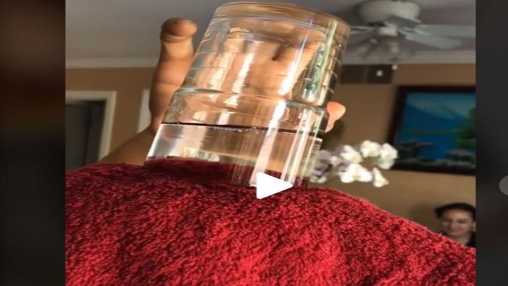 VIDEO – Și-a pus în cap un prosop și un pahar întors cu apă – La ce ajută acest tratament
