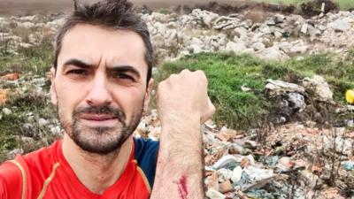 Alex Găvan, accidentat pe un câmp de lângă Corbeanca, din cauza unor bucăți de moloz aruncate prin iarbă Foto: Facebook.com
