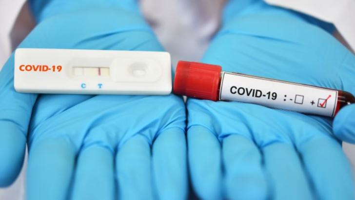 Teste rapide antigen pentru depistarea COVID