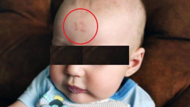 Medicii, uimiţi de semnul care i-a apărut unui bebeluş pe frunte, după naştere FOTO