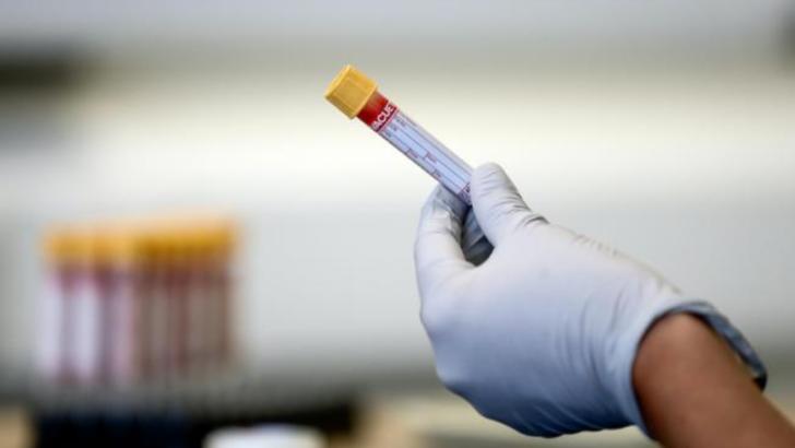 Marea Britanie a început testarea unui spray nazal împotriva noului coronavirus Foto: Lancashiretelegraph.co.uk