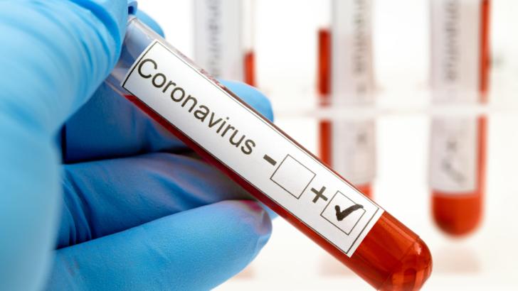 coronavirus Foto: Pixabay.com