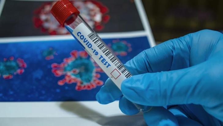 testare coronavirus Foto: Pixabay.com