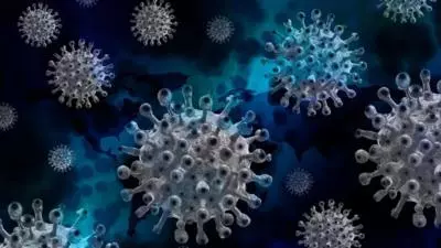 Infecție COVID-19