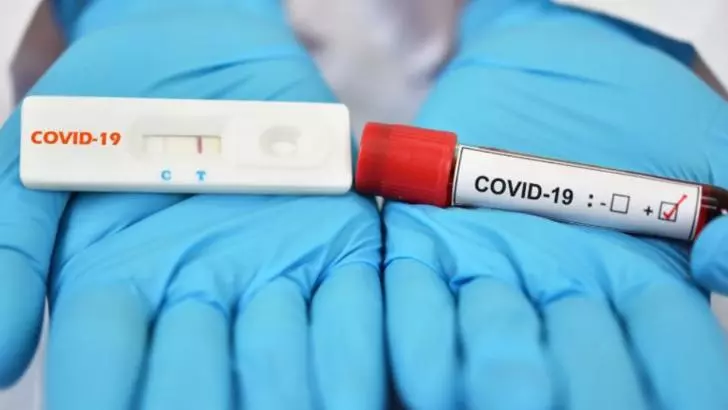 Teste COVID