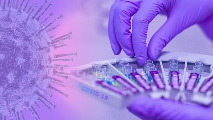testare coronavirus Foto: Pixabay.com
