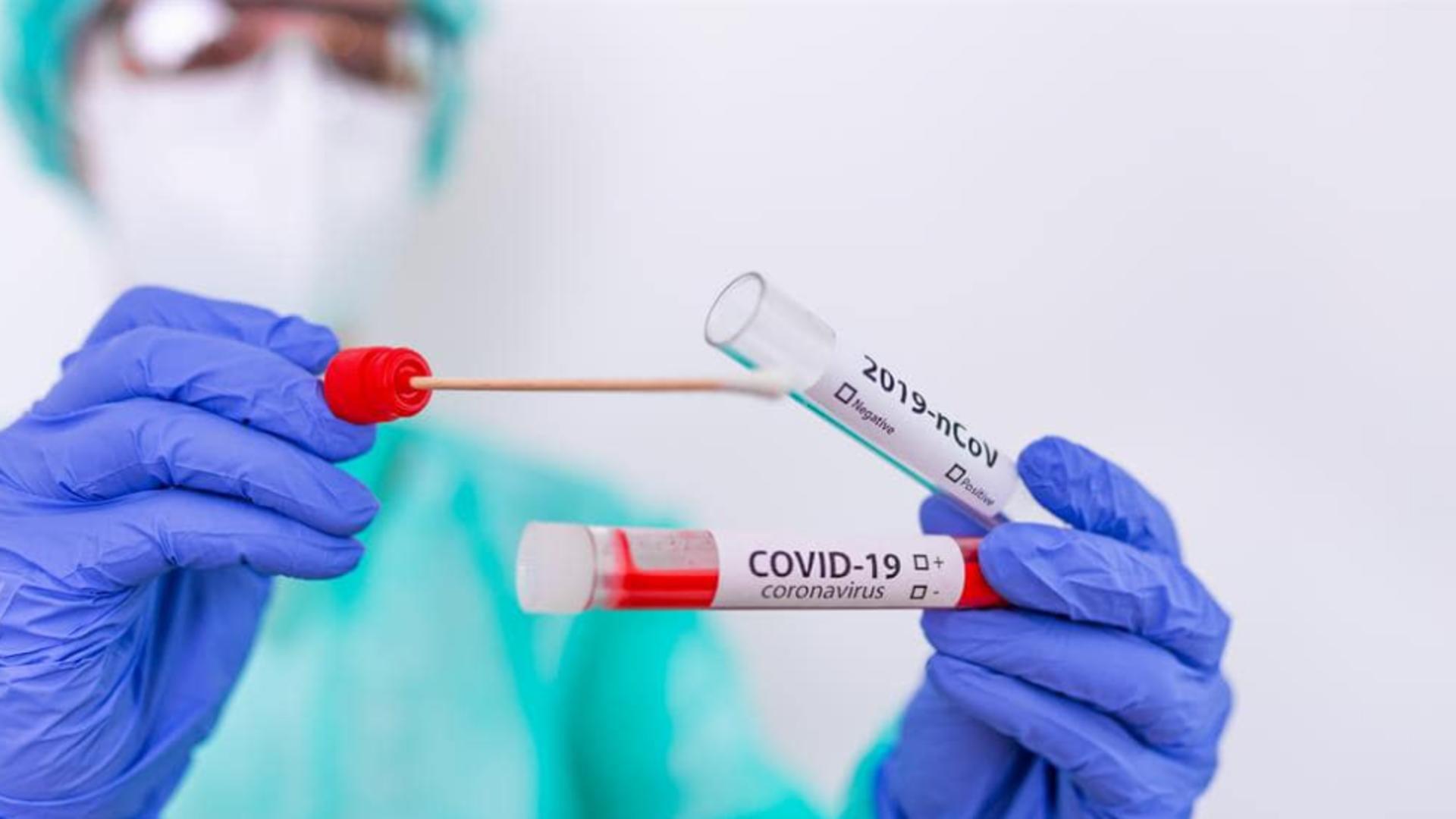 Teste pentru detectarea infectării cu SARS CoV-2
