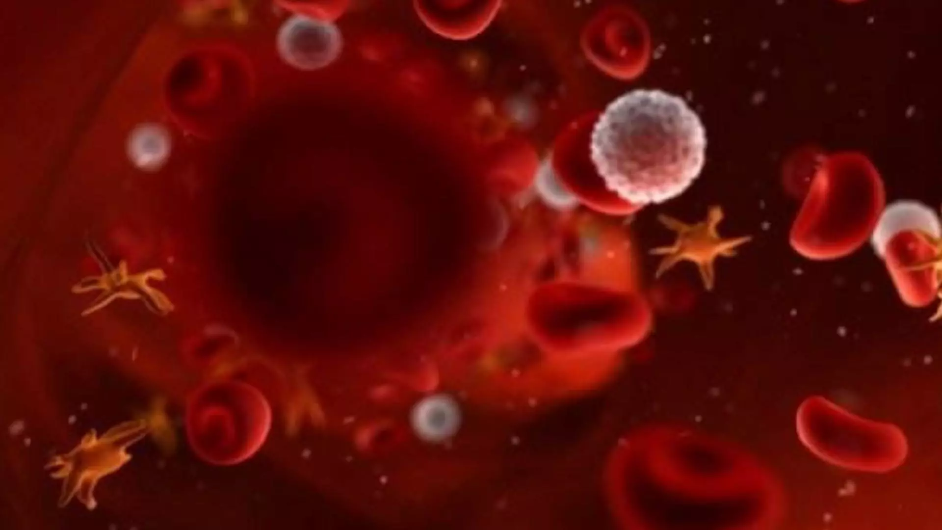 Reacții adverse severe după vaccinarea cu AstraZeneca - Mărturia unei paciente cu simptome de tromboză