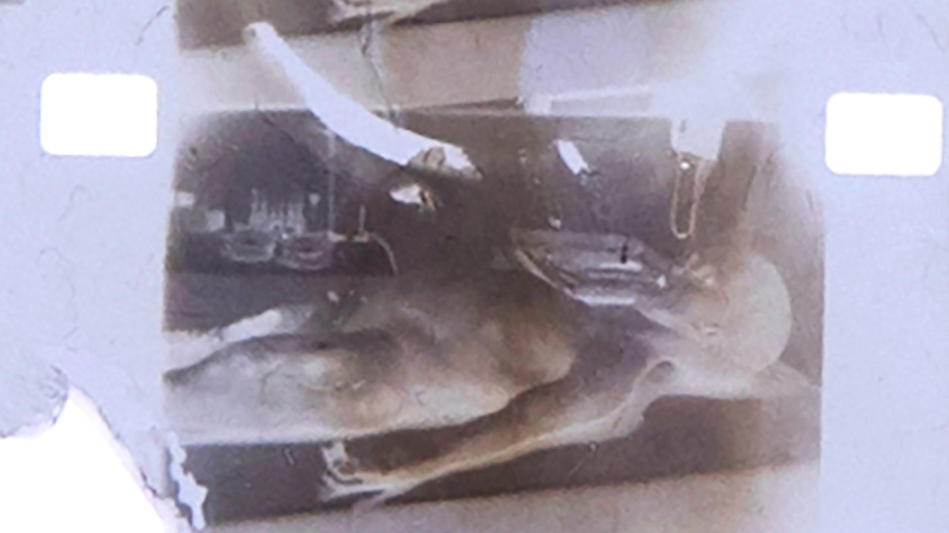 Fotografie realizată după negativul fimului autopsiei de la Roswell