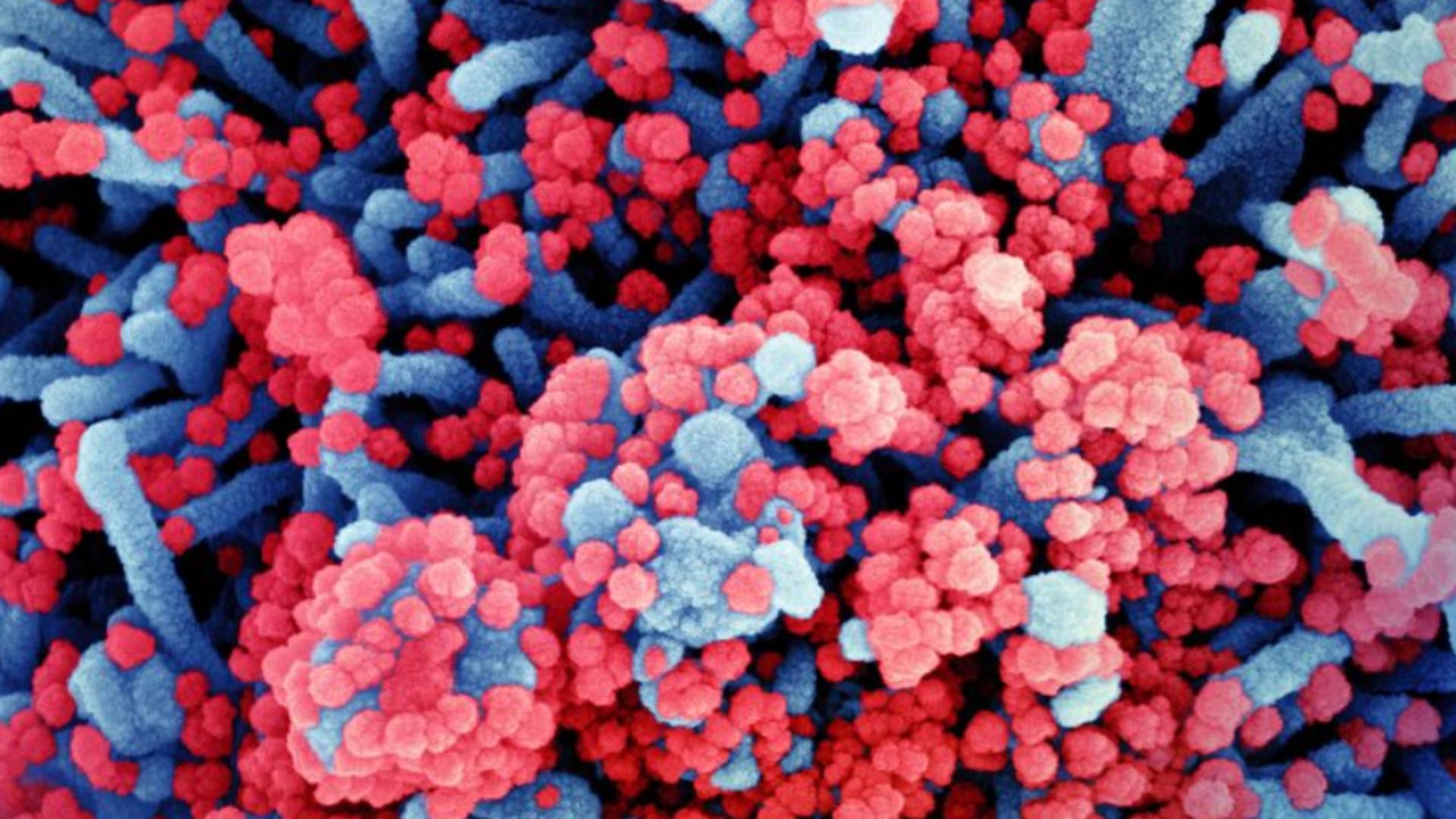 STUDIU Coronavirusul are o abilitate extraordinară: devine mai INFECȚIOS prin multiplicarea în glandele salivare