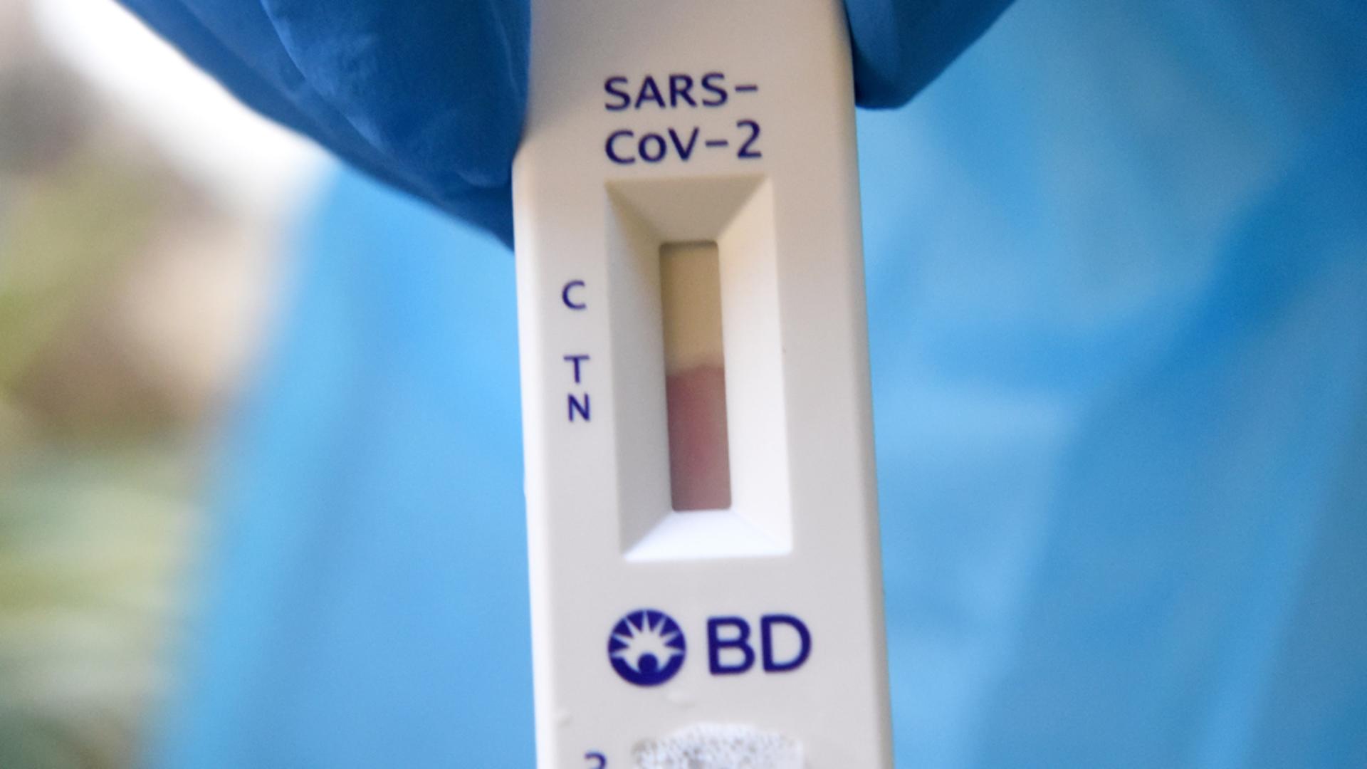 Test antigen / Sursă photo - Profi Media