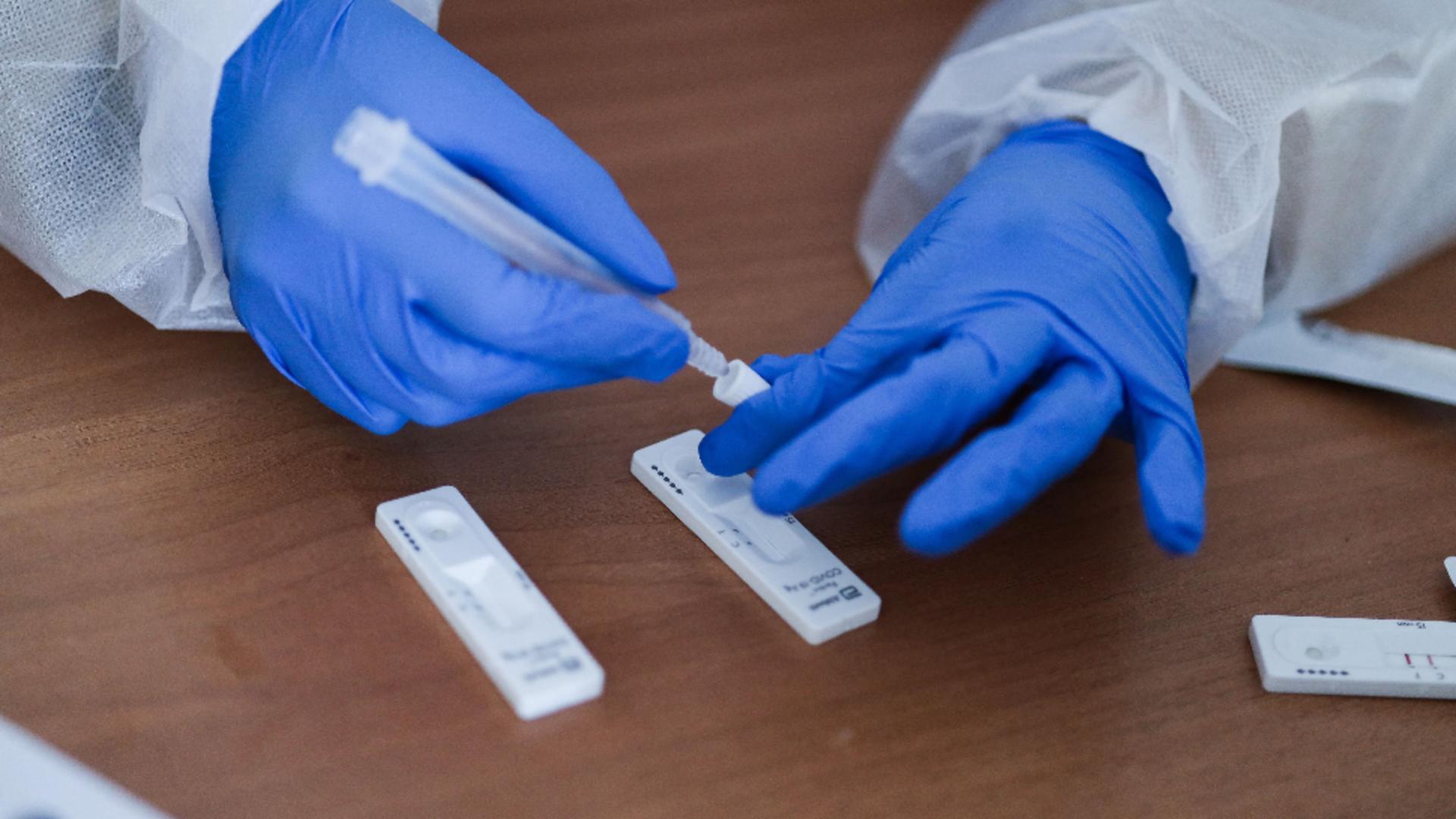 Teste antigen. Foto: ProfiMedia