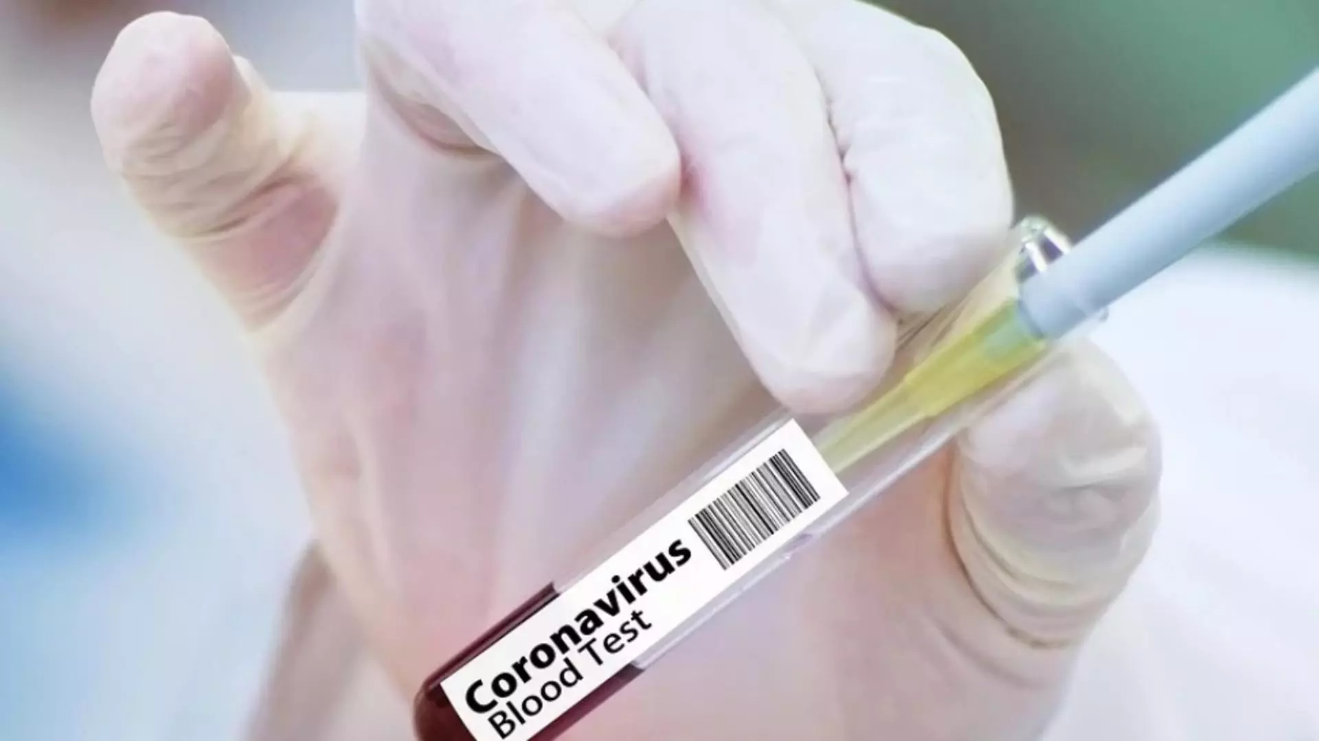 Infecție COVID-19