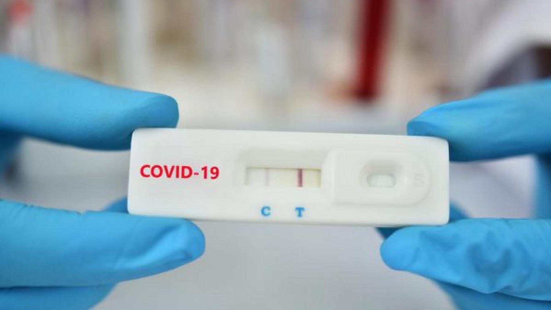 Testare antigen COVID-19