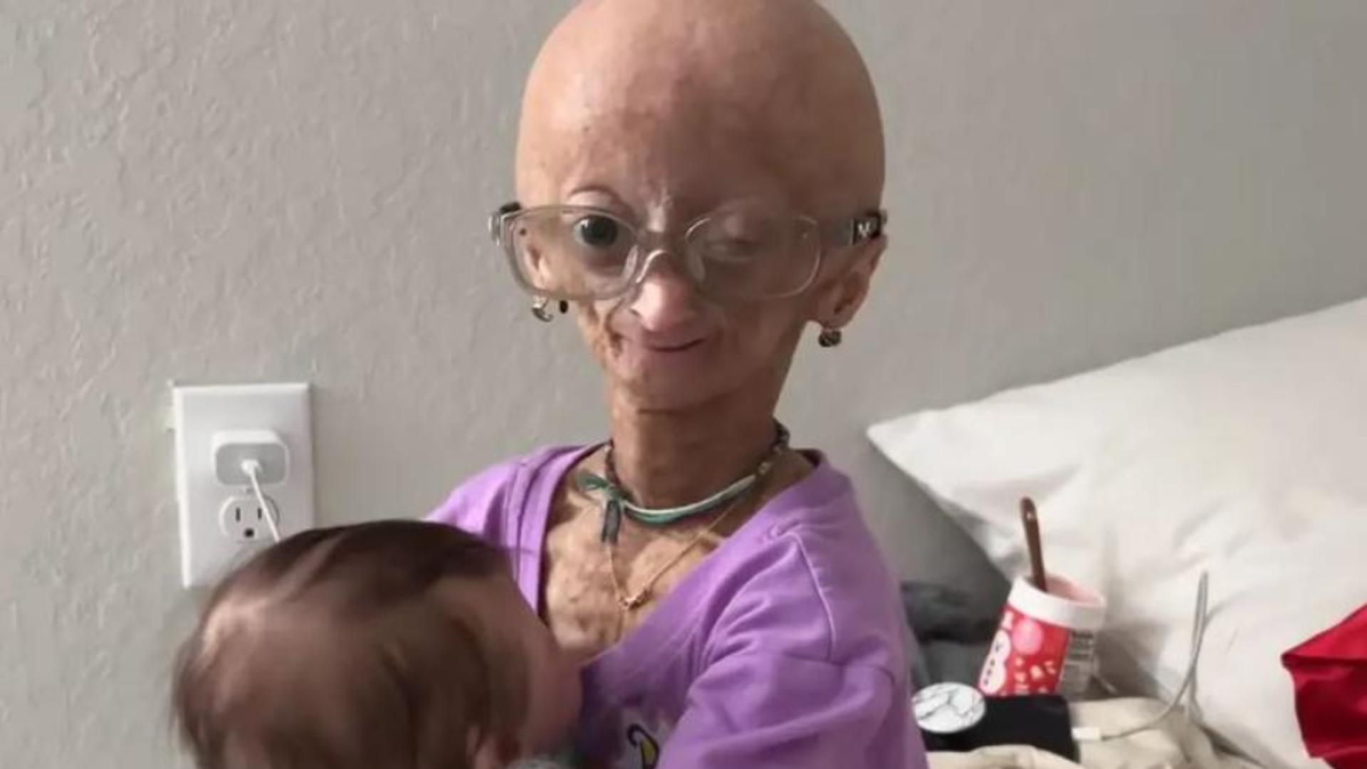 Adalia Rose Williams