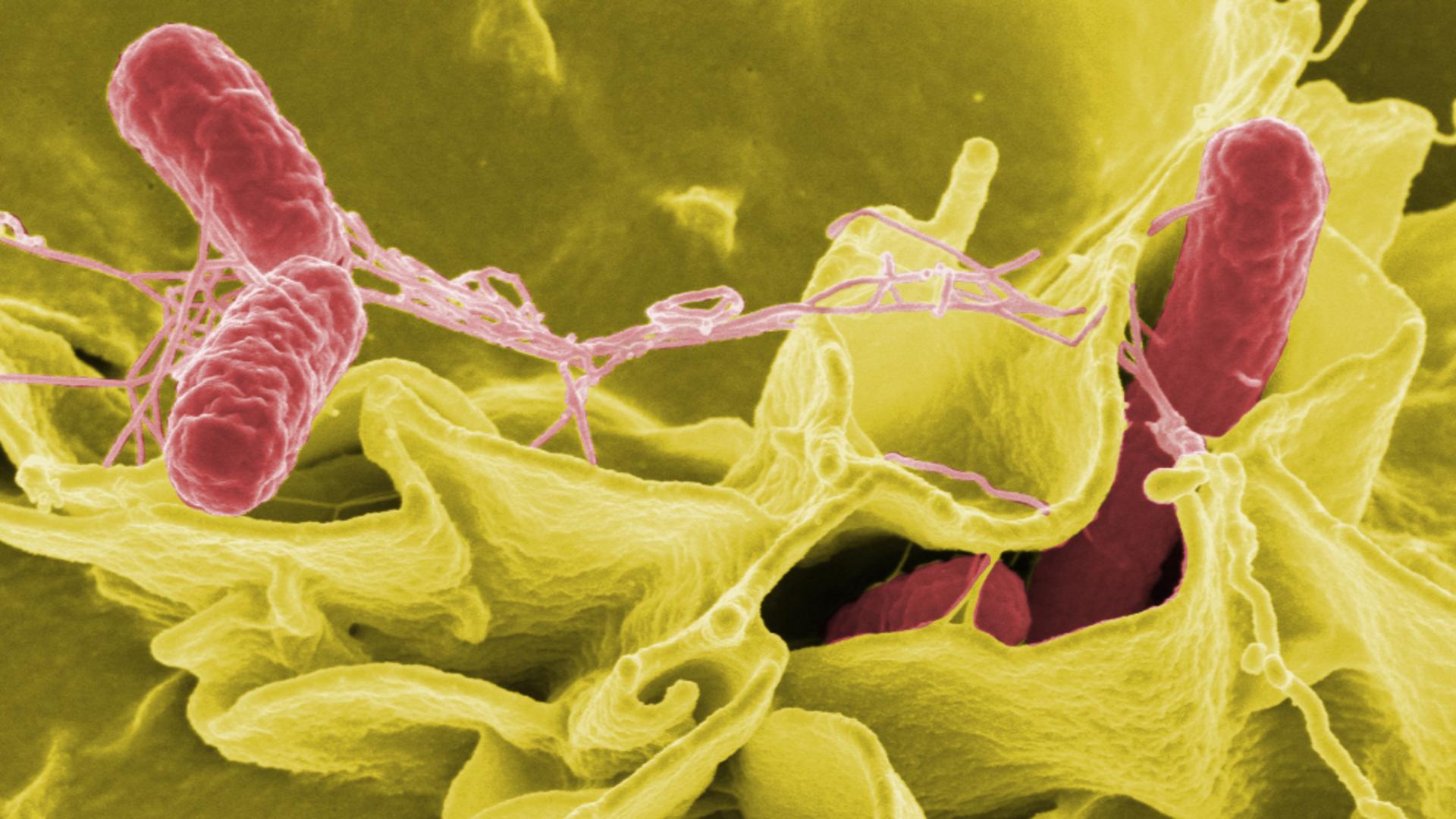 Ce este Salmonella. Sursa foto: Wikipedia