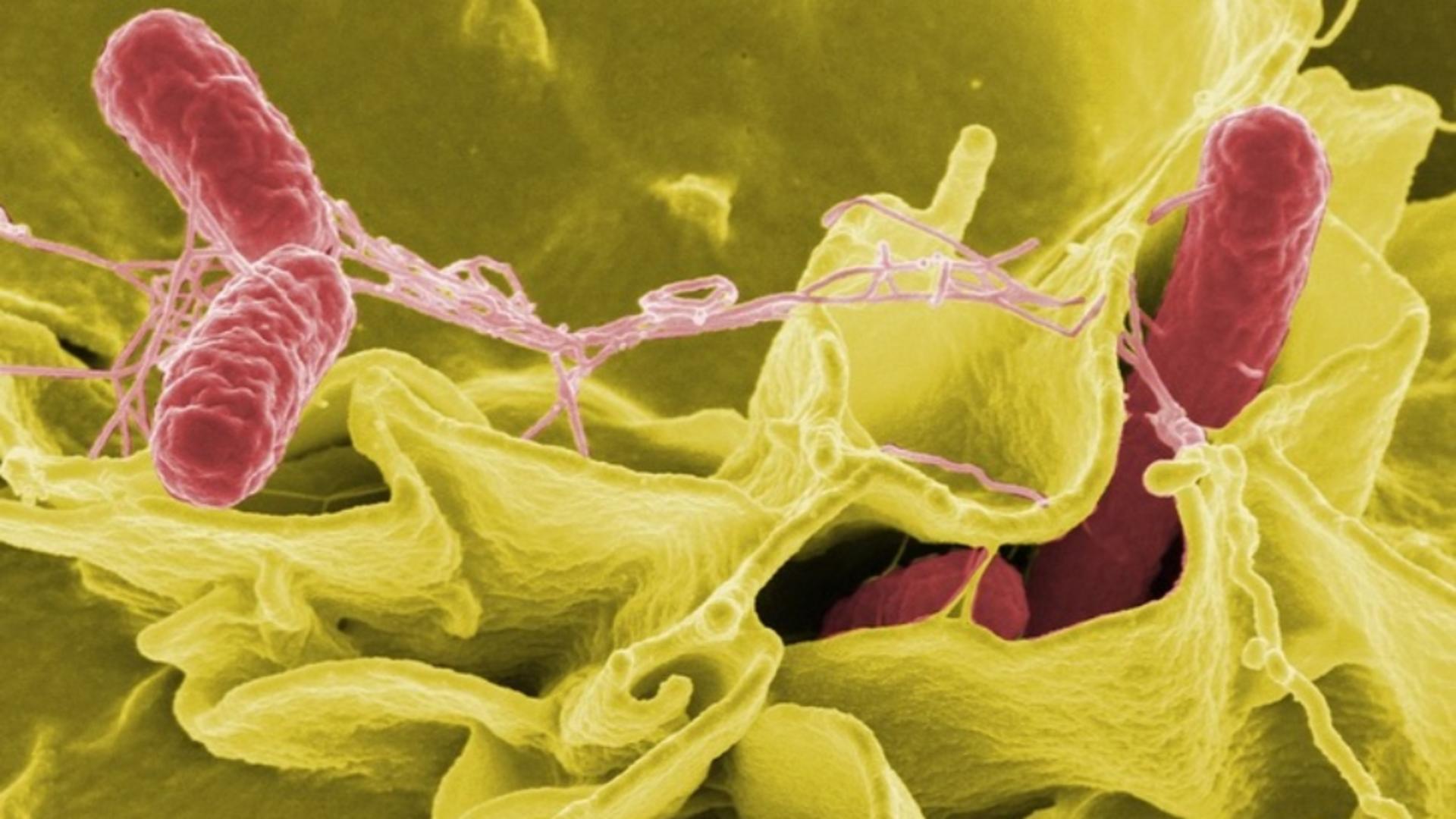 Bacteria ucigașă care poate fi luată din camera de hotel