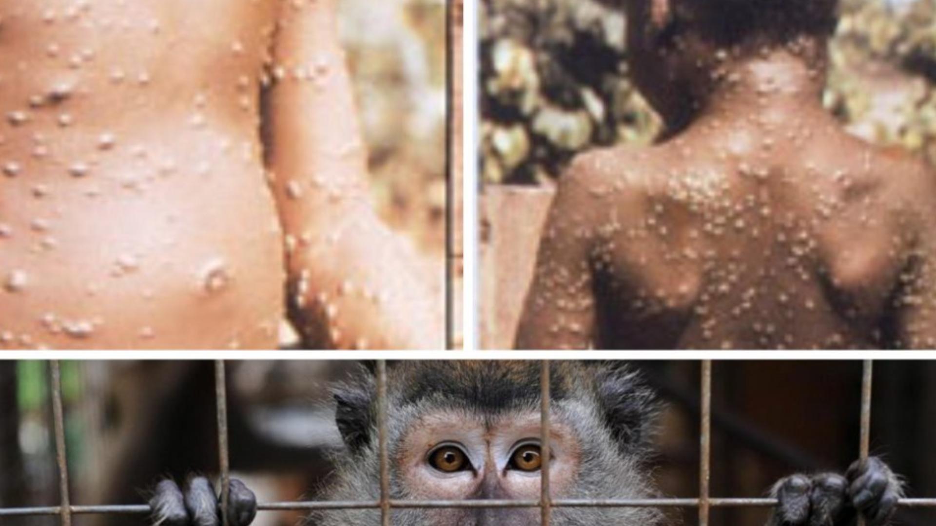 OMS menține ALERTA la nivel mondial pentru variola maimuței - Peste 70.000 de infectări de la debutul epidemiei, în 6 luni