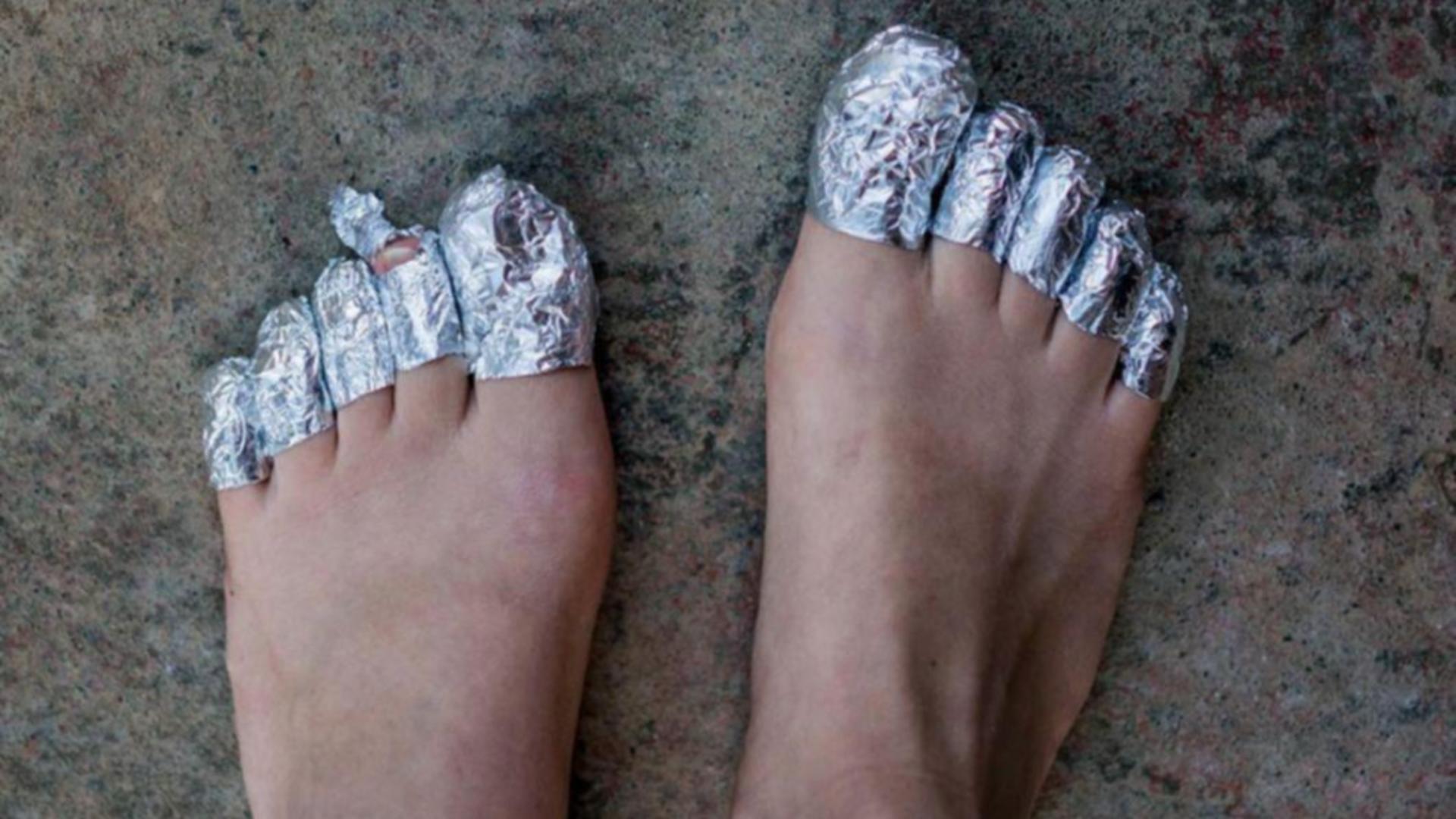 Folie de aluminiu pe degetele de la picioare
