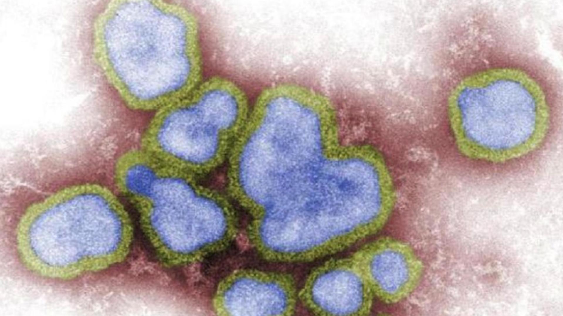 Primul deces de gripă aviară într-o țară asiatică - O fetiță de 11 ani a murit la puțin timp de la infectare - Avertisment sumbru