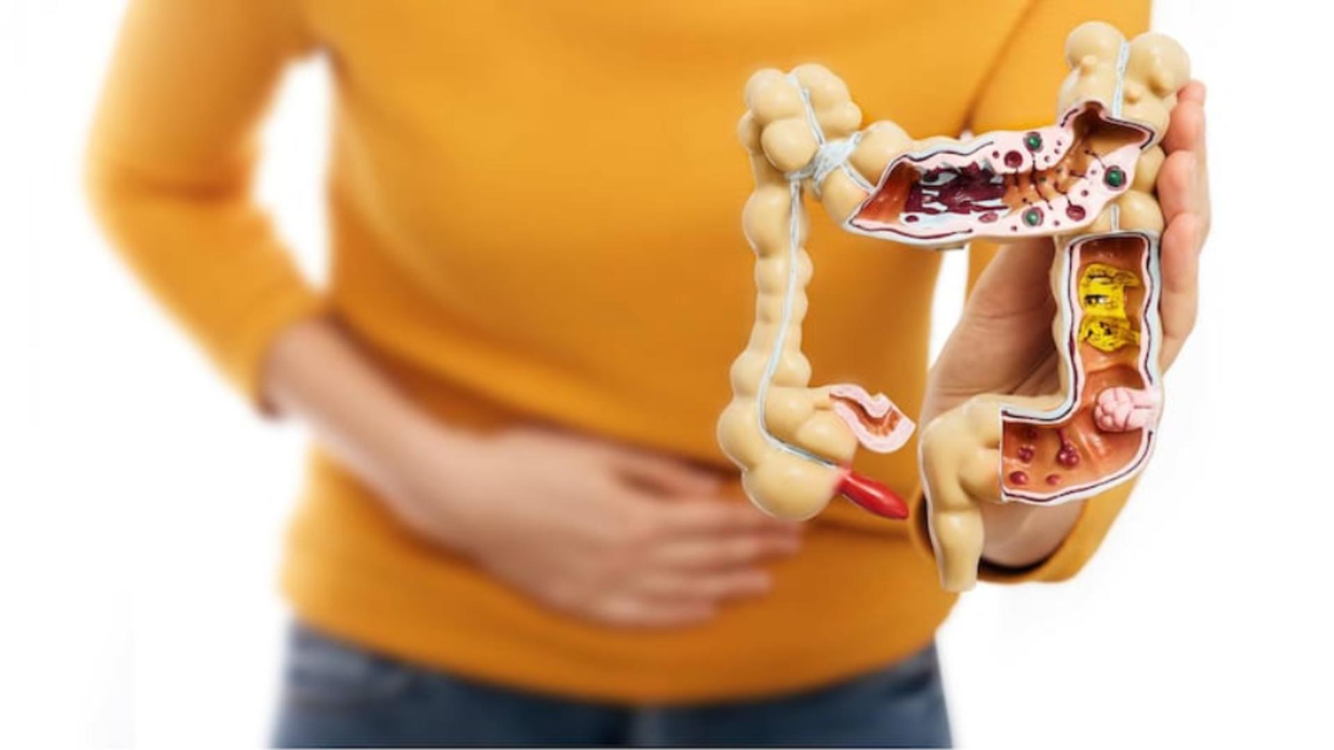 Sfaturi de la nutriționiști. O metodă foarte ușoară de a îmbunătăți sănătatea intestinală